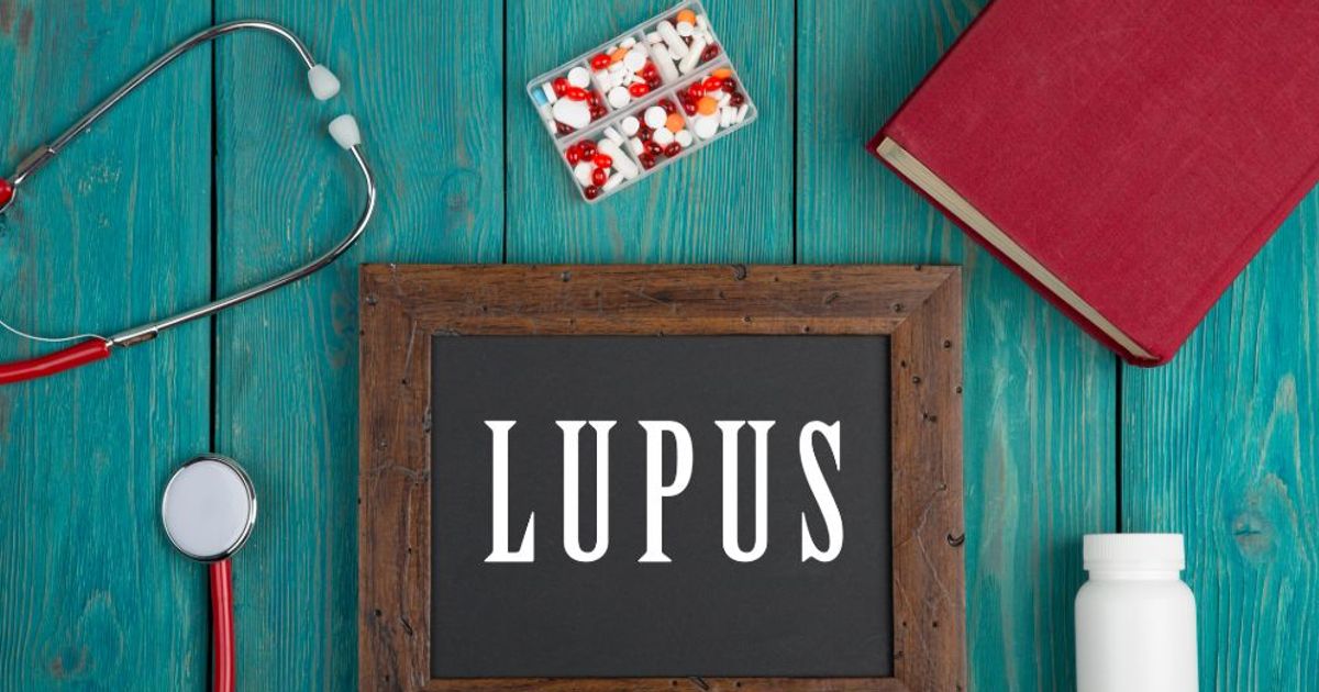 Coping with Lupus: Practical Tips for Daily Living - Facty Health