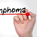 What Causes Lymphoma?
