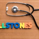 What are Gallstones?