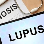 Treatments for Lupus