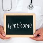 12 Signs and Symptoms of Lymphoma