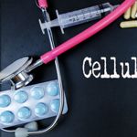 10 Symptoms Of Cellulitis