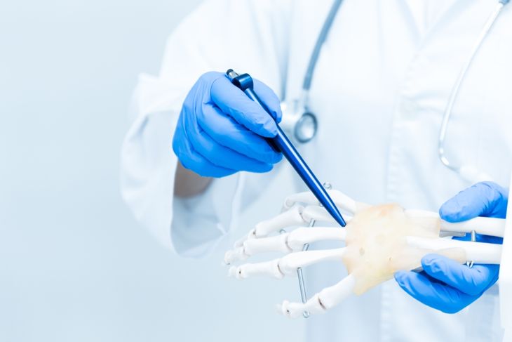 Gout often starts in a single joint — typically the big toe — a condition known as monoarticular gout. However, it can also affect other joints such as the ankle, knee, or fingers. In some cases, multiple joints become inflamed over time (polyarticular gout), particularly if the condition goes untreated.
