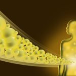 Treatment for Gallstones