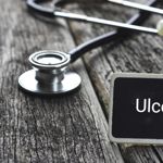 10 Signs of an Ulcer