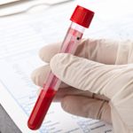 Top 10 Complete Blood Count