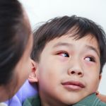 Nine Natural Ways to Alleviate Pink Eye Symptoms