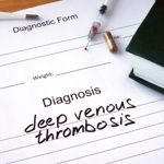 10 Deep Vein Thrombosis Symptoms