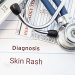 Skin Rashes and Their 12 Potential Causes