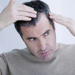 Top Causes of Hair Loss in Men