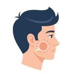 10 Acne Trigger Foods: Avoid These Foods to Prevent Breakouts!