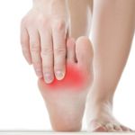 10 Treatments for Plantar Fasciitis