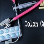 Colon Cancer Symptoms and Stages