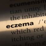 10 Treatments For Eczema