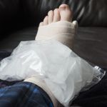 10 Simple Techniques for Relieving Swollen Ankles
