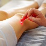 10 Ways to Get Rid of Varicose Veins