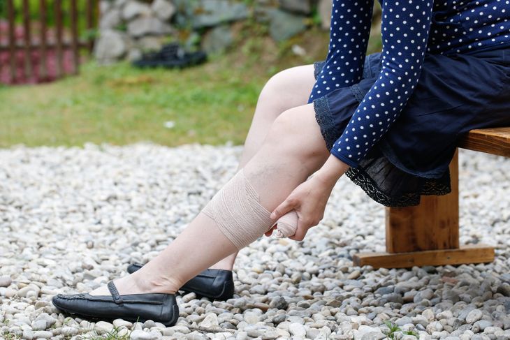 Deep Vein Thrombosis: 10 Causes and Risk Factors