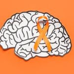 Could You Have MS? 13 Symptoms to Watch Out For