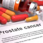 Ignoring These 10 Signs Could Lead to Late Prostate Cancer Diagnosis