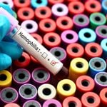 10 Symptoms of Hemophilia