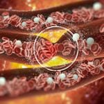 Blood Clot Prevention: Effective Tips to Stay Safe
