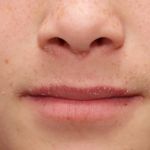 10 Remedies for Dry Mouth