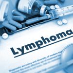 10 Signs of Lymphoma