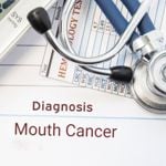 10 Indicators of Mouth Cancer You Shouldn't Ignore