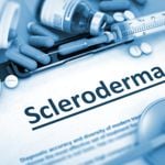 Scleroderma: A Silent Threat with 10 Major Symptoms