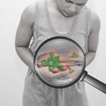 Stomach Cancer Treatments: A Comprehensive Guide