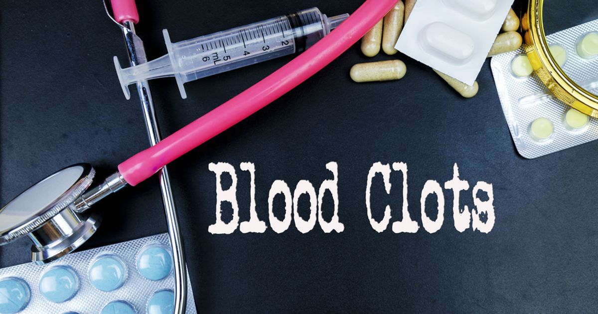 Blood Clot in the Leg Symptoms Facty Health