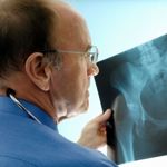 10 Symptoms of Osteoporosis
