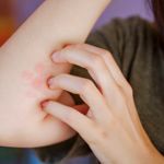 10 Causes of Ringworm