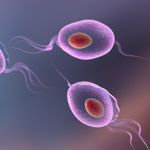 Trichomoniasis: The Silent STD and its 10 Symptoms