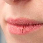 Understanding Dry Mouth: 10 Symptoms to Look Out For