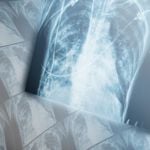 11 Causes of COPD