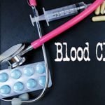 Blood Clot in the Leg Symptoms
