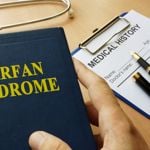 10 Essential Symptoms of Marfan Syndrome