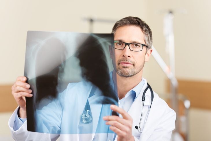 10 Causes of Lung Cancer