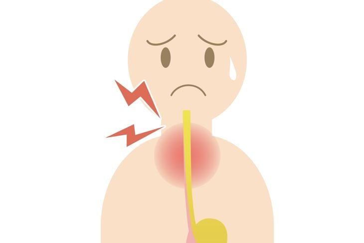 Person with throat irritation caused by acid reflux due to gastroesophageal reflux disease (GERD)