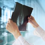 10 Treatments for Breast Cancer