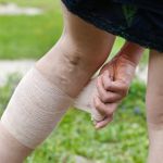 10 Signs of Deep Vein Thrombosis
