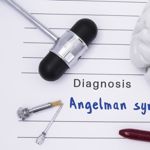10 Symptoms of Angelman Syndrome