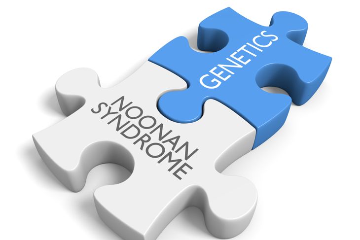 10 Symptoms of Noonan Syndrome