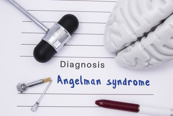 10 Symptoms of Angelman Syndrome