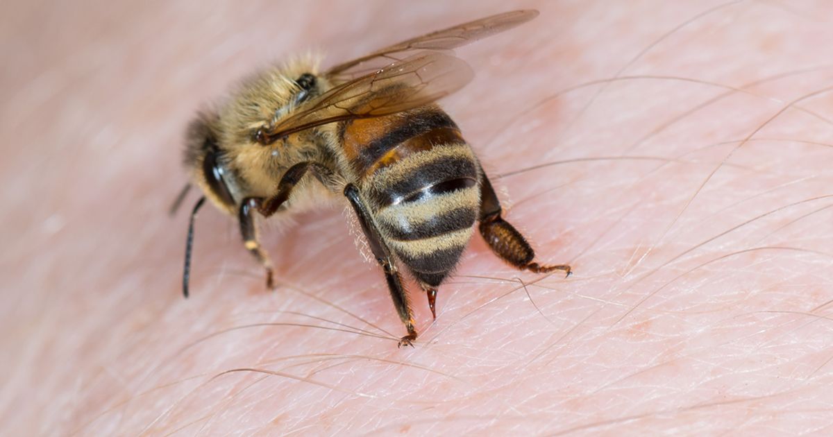 10 Home Remedies for Bee Stings Facty Health