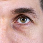 Simple Steps to Reduce Dark Circles at Home