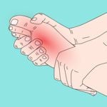 10 Home Remedies for Swollen Feet