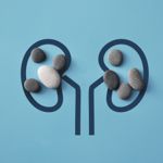 10 Home Remedies for Kidney Stones