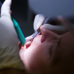 15 Simple Remedies to Alleviate Gum Disease Symptoms